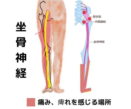 腰痛・下肢痛 - 名古屋市でスポーツによる痛み治療なら名古屋スポーツ