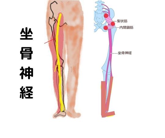 脊柱管狭窄症、坐骨神経、腰椎椎間板ヘルニア